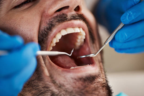 Best Emergency Treatment for Jaw Pain or Injury in Benson, MN